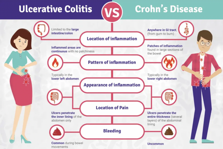 Understanding Inflammatory Bowel Disease (IBD): What is Crohn's and ...